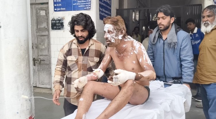 शहर के बीचों-बीच गूंजा धमाका: बंदूक की दुकान में वेल्डिंग के दौरान ब्लास्ट, 4 लोग गंभीर रूप से झुलसे