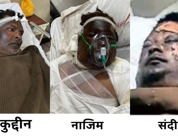 वेल्डिंग कार्य के दौरान विस्फोट से घायल हुए प्रभावितों को मुख्यमंत्री स्वेच्छानुदान से एक-एक लाख रुपये स्वीकृत, कैबिनेट मंत्री काश्यप की पहल पर  प्रभावितों को राशि स्वीकृत