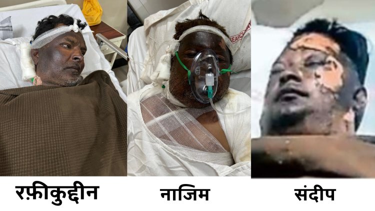 वेल्डिंग कार्य के दौरान विस्फोट से घायल हुए प्रभावितों को मुख्यमंत्री स्वेच्छानुदान से एक-एक लाख रुपये स्वीकृत, कैबिनेट मंत्री काश्यप की पहल पर  प्रभावितों को राशि स्वीकृत